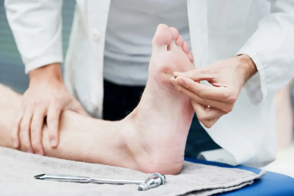 Image of a doctor putting pressure on the underside of a foot with a needle to test for diabetic neruopathy