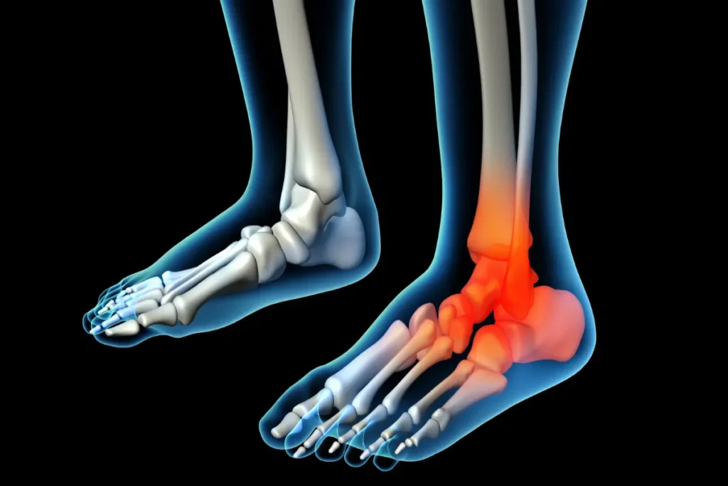 X ray illustration of the bones of a foot, highlighted in red to show sharp pain in foot