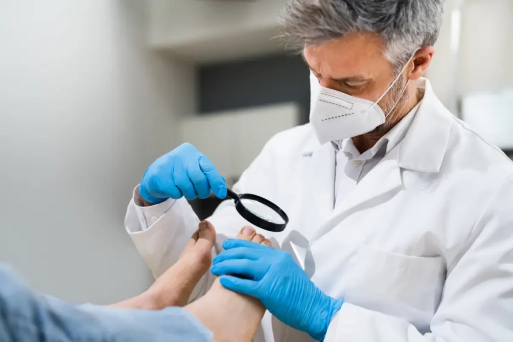 Doctor with mask and blue gloves on examining a foot with a magnifying glass as part of toenail removal aftercare