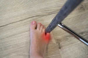 Image of foot hitting a barstool leg and breaking the pinky toe