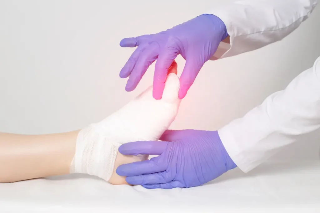 Purple-Gloved hands of doctor examining a foot with a white sock on because of a broken pinky toe