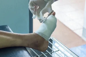 Foot wrapped in bandaging and a doctor using scissors to prepare to cut it off the foot.