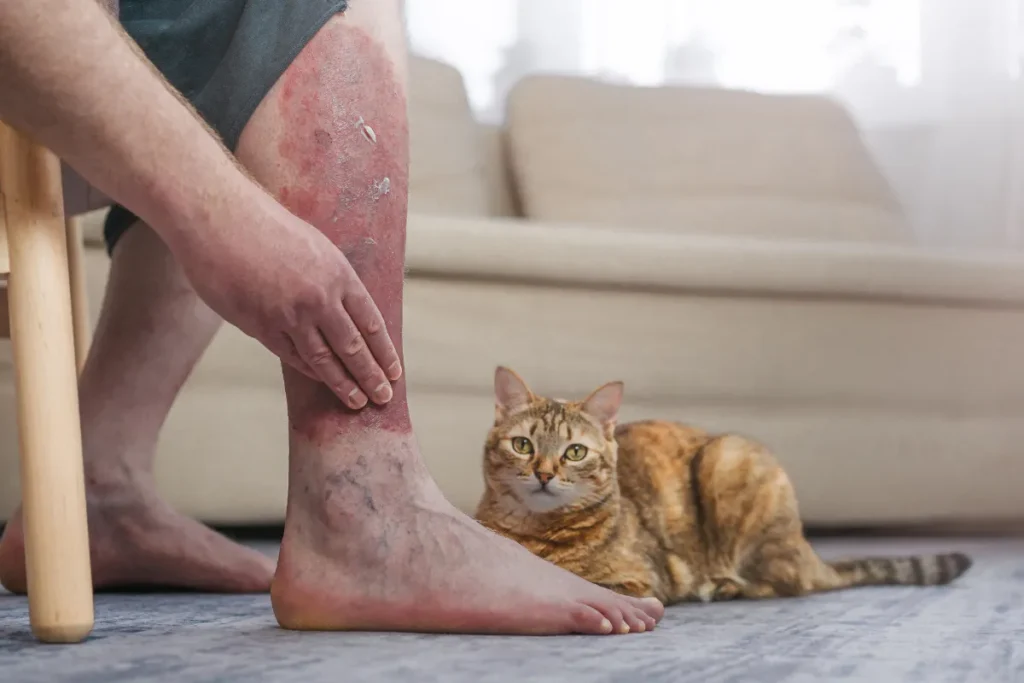 Image of foot and leg with psoriasis and had scratching it, with a cat on the floor in front of a couch in the background