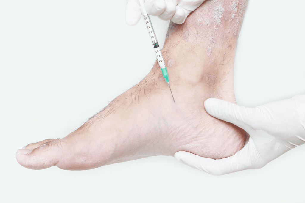 Gloved hands inserting a needle into the side of a foot